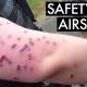 Airsoft Gun Bruises: Causes, Prevention & Care | Ultimate Airsoft Guide for Beginners, Tactics & Gear Reviews