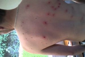 Airsoft Guns: Preventing Marks on Skin & Safety Tips | Ultimate Airsoft Guide for Beginners, Tactics & Gear Reviews