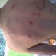 Airsoft Guns: Preventing Marks on Skin & Safety Tips | Ultimate Airsoft Guide for Beginners, Tactics & Gear Reviews
