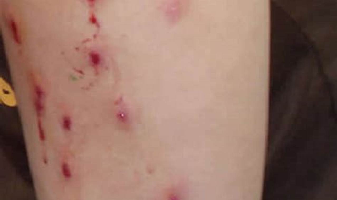 Airsoft Bruises: Prevent & Treat Your Airsoft Marks Ultimate Airsoft Guide for Beginners, Tactics & Gear Reviews Airsoft Bruises: Prevent & Treat Your Airsoft Marks | Ultimate Airsoft Guide for Beginners, Tactics & Gear Reviews