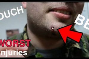 Guide to Airsoft Injuries: Prevention & Treatment Ultimate Airsoft Guide for Beginners, Tactics & Gear Reviews Guide to Airsoft Injuries: Prevention & Treatment | Ultimate Airsoft Guide for Beginners, Tactics & Gear Reviews