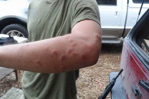 Airsoft Welts: Causes, Prevention & Care Guide | Ultimate Airsoft Guide for Beginners, Tactics & Gear Reviews