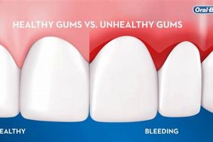 Best Airsoft Gums Guide: Gear Up & Play Safe! | Ultimate Airsoft Guide for Beginners, Tactics & Gear Reviews