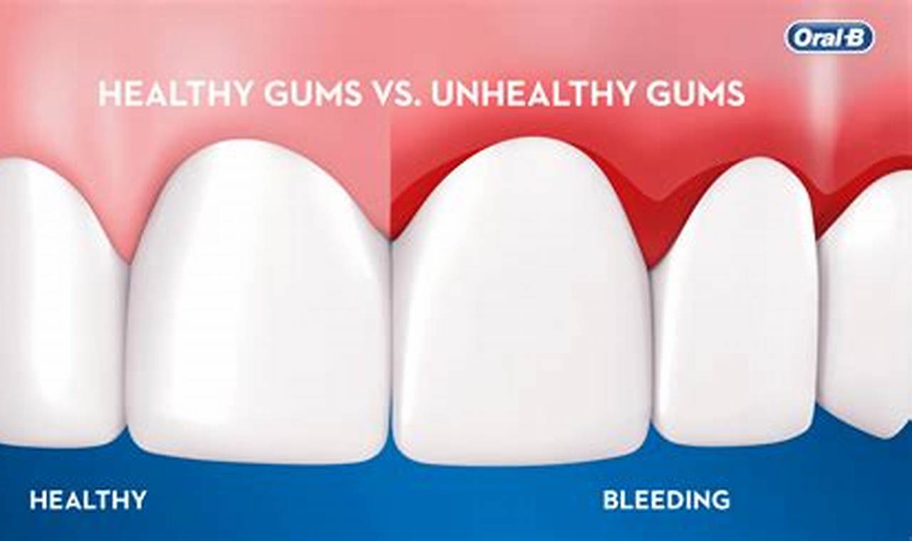 Best Airsoft Gums Guide: Gear Up & Play Safe! | Ultimate Airsoft Guide for Beginners, Tactics & Gear Reviews